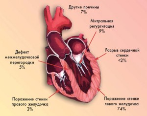 Роль различных механизмов,ответственных за развитие кардиогенного шока