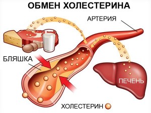 Образование опасных холестериновых отложений