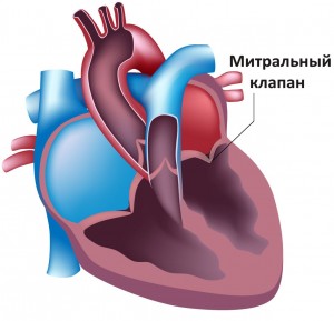 Пролапс митрального клапана