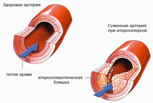 Особенности развития заболевания