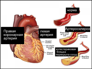 Особенности заболевания