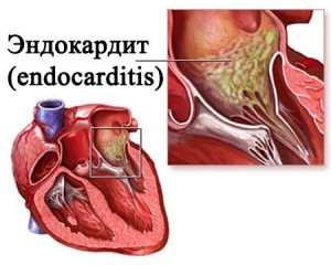 Общая картина болезни