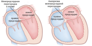 В чем суть заболевания