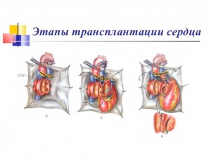 Хирургическое лечение недуга