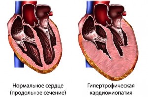 Особенности заболевания