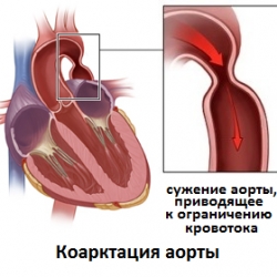 В чем суть заболевания