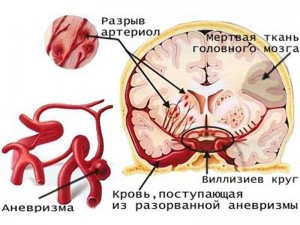 Как развивается патология