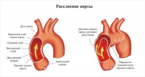 Общие сведения о заболевании