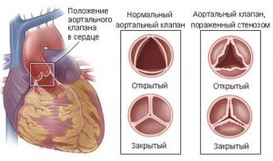 Формы и причины развития болезни