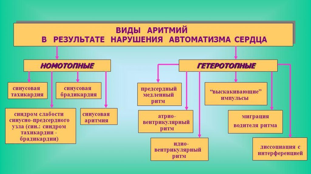 виды аритмии-1