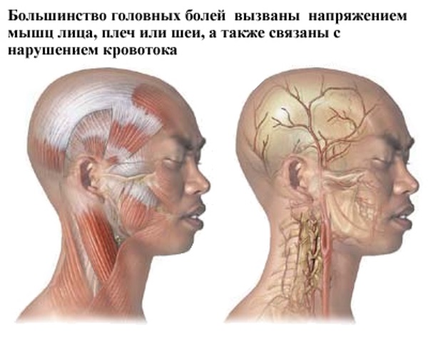 Этиология и причины развития мигрени 